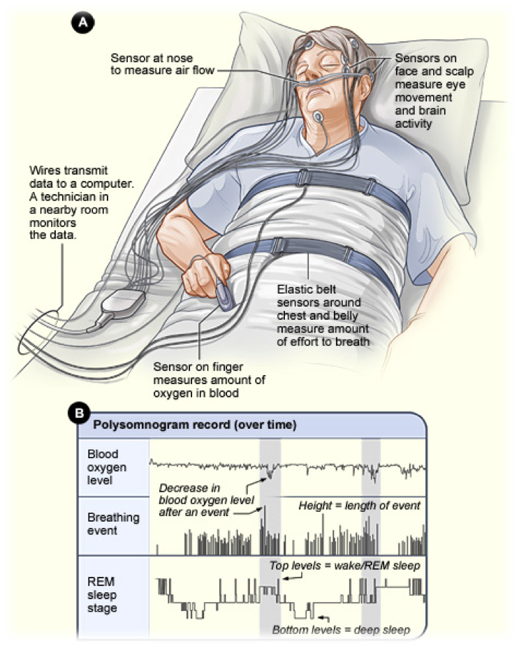 Polysomnography - Wikipedia