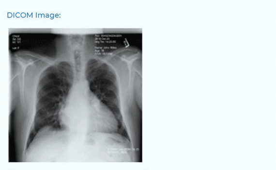 de-identified health data