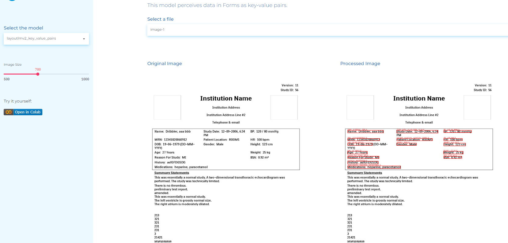 Use case of NLP for financial documents: perceiving data in forms as key-value pairs.