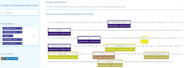 Clinical language processing for automatically identifying anatomical system.