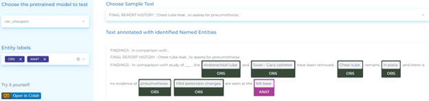 Clinical NLP for detecting anatomical and observation entities in chest radiology reports.