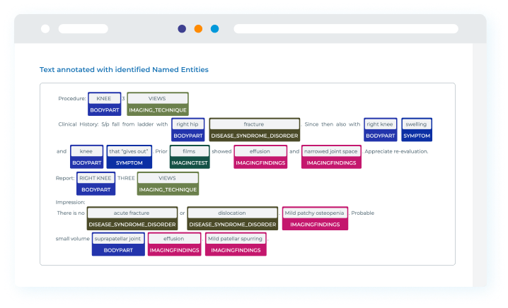 Example of radiology text annotated identified names entities