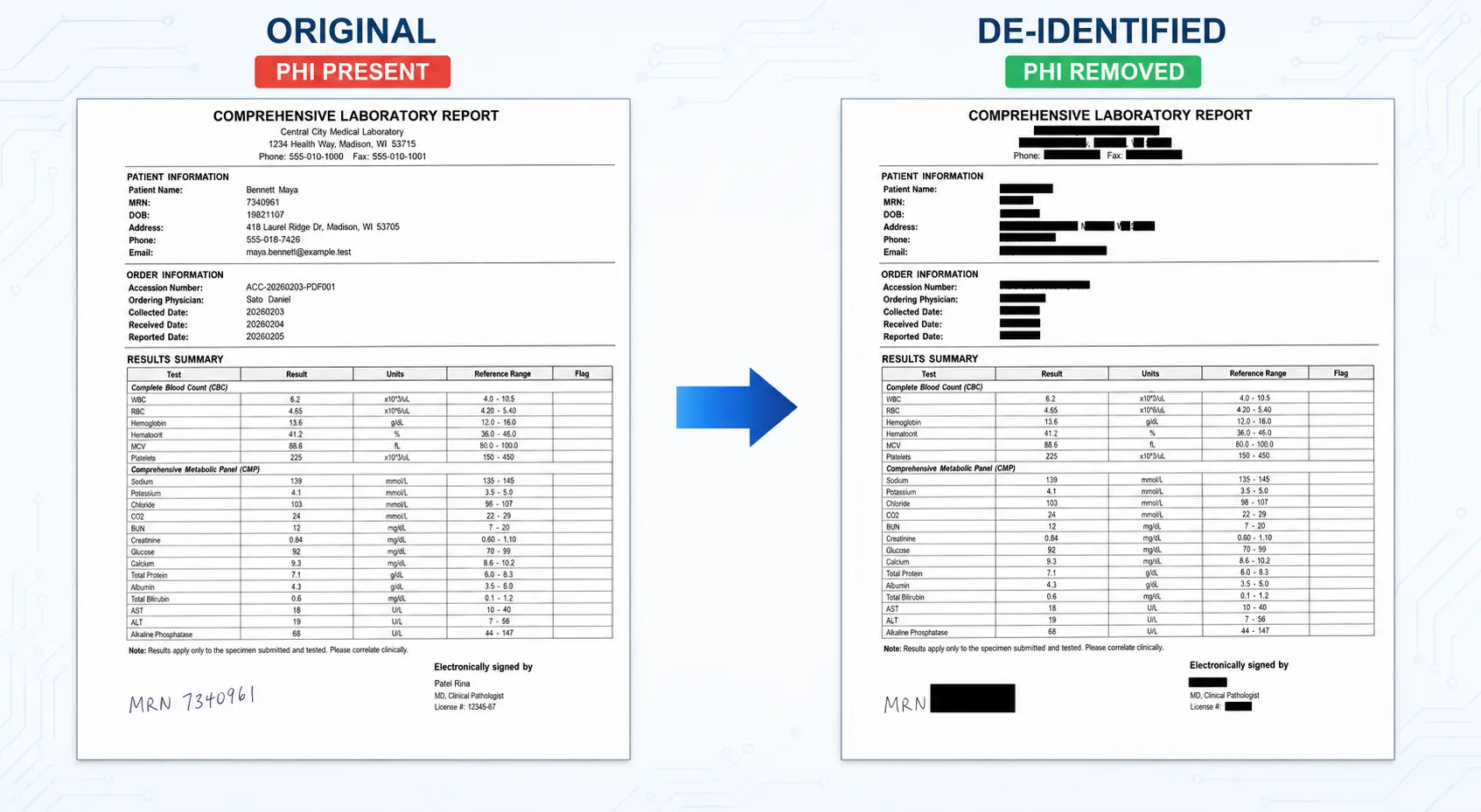 Laboratory report before and after PHI de-identification.